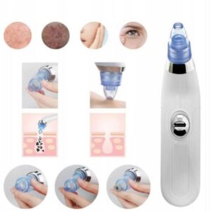 Extractor De Puntos Negros